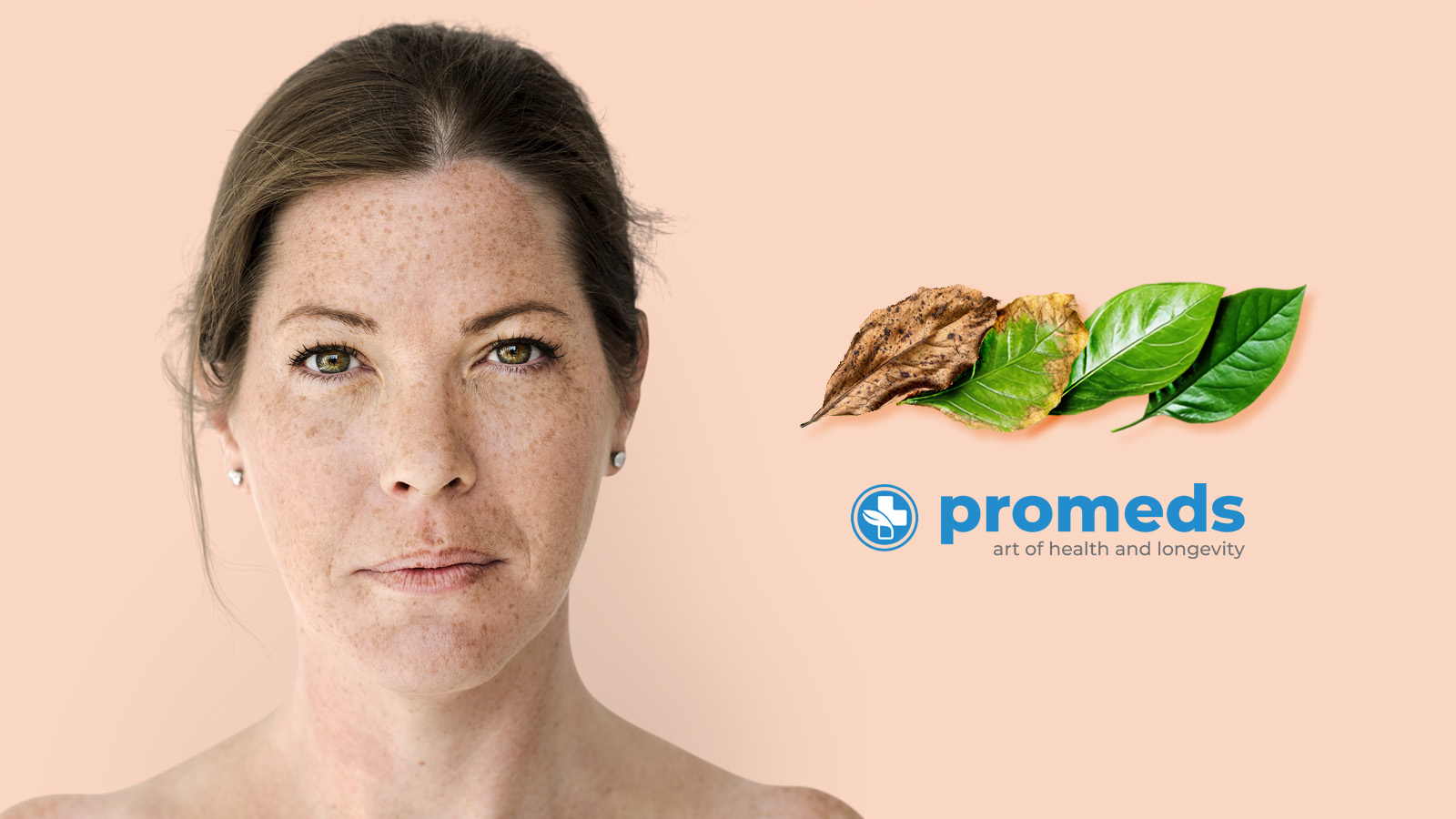 Hyperpigmentation laser treatment in Derby using advanced Sciton technology