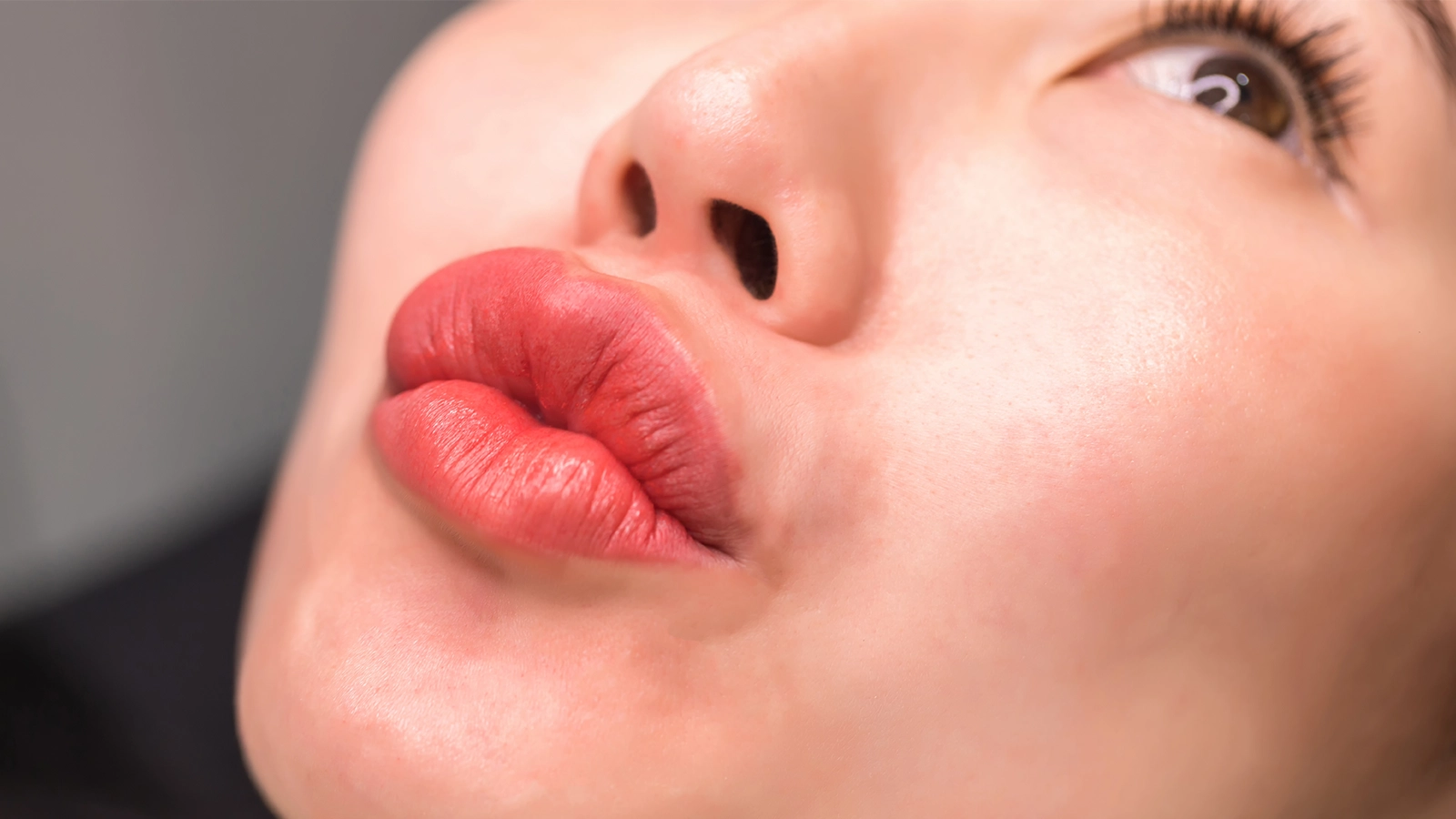 Lip Flip vs. Lip Filler Comparison