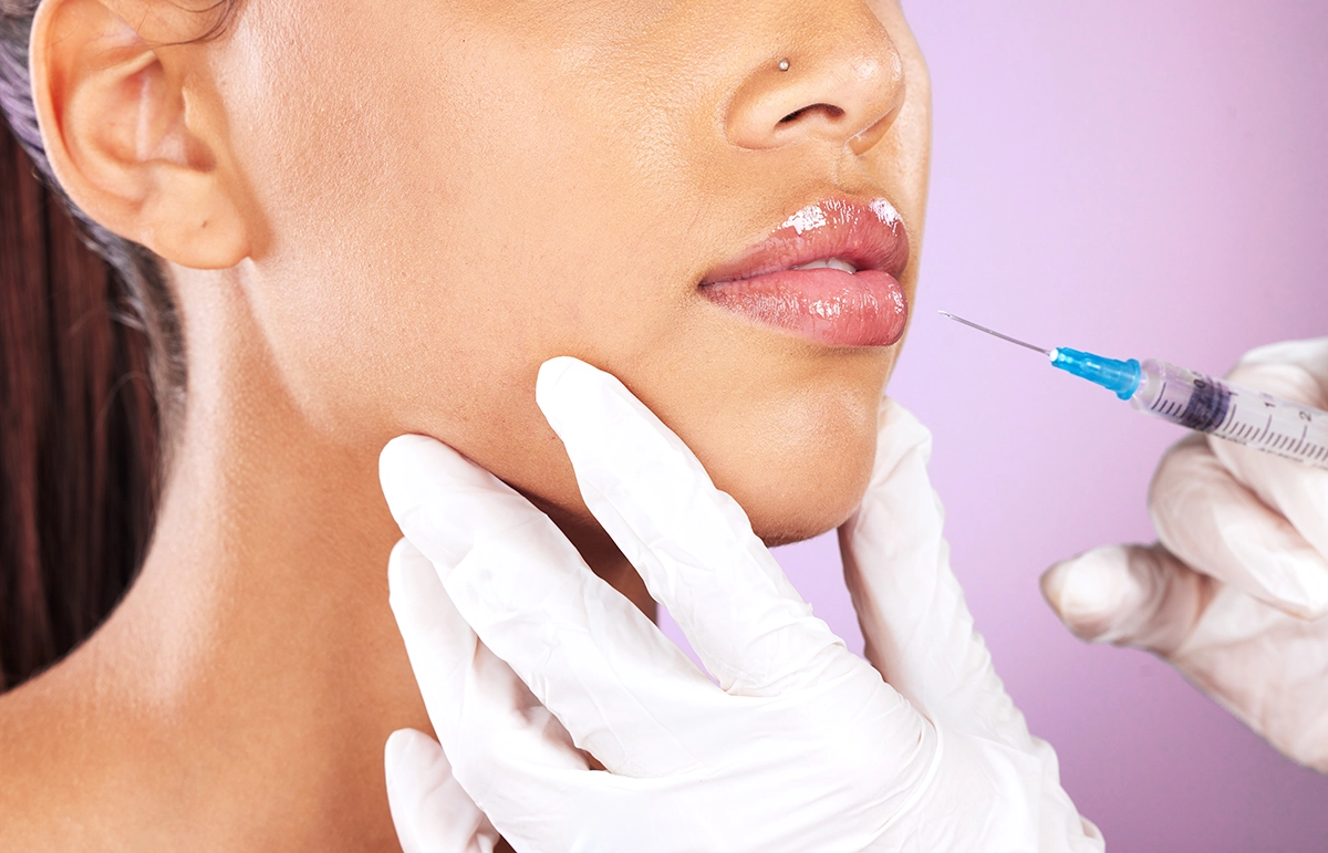Dermal Fillers
